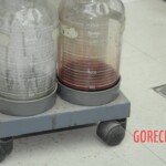 Dissection of stabbed woman