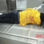 Dissection of stabbed woman