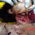 Naked murdered woman