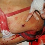 Murdered Brazilian woman