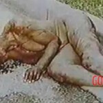 Eyeball killer victim