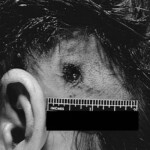 Eyeball killer victim