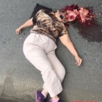 Woman's brain popped out
