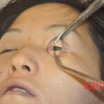 Naked dead lady in bed