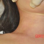 Naked dead lady in bed