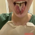 Tongue split fail