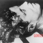 John F. Kennedy autopsy