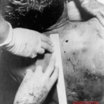 John F. Kennedy autopsy