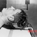 John F. Kennedy autopsy