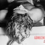 John F. Kennedy autopsy