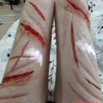 self harm