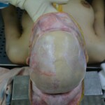 Autopsy of stabbed girl