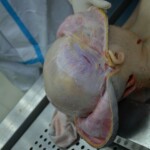 Autopsy of stabbed girl