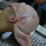 Autopsy of stabbed girl