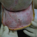 Autopsy of stabbed girl