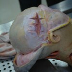 Autopsy of stabbed girl