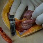 Autopsy of stabbed girl