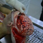 Autopsy of stabbed girl