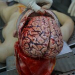 Autopsy of stabbed girl