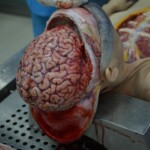 Autopsy of stabbed girl