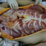 Autopsy of stabbed girl