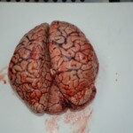 Autopsy of stabbed girl