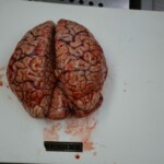 Autopsy of stabbed girl