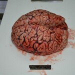 Autopsy of stabbed girl