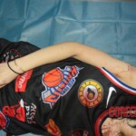 Stabbed teenage girl