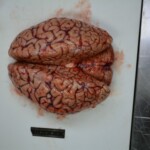 Autopsy of stabbed girl