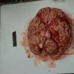 Autopsy of stabbed girl