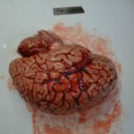 Autopsy of stabbed girl