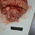 Autopsy of stabbed girl