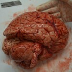 Autopsy of stabbed girl