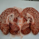 Autopsy of stabbed girl