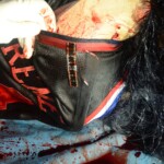 Stabbed teenage girl