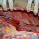 Autopsy of stabbed girl