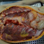 Autopsy of stabbed girl