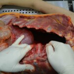 Autopsy of stabbed girl