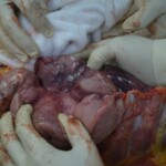 Autopsy of stabbed girl