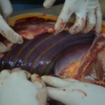 Autopsy of stabbed girl