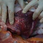 Autopsy of stabbed girl