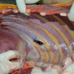 Autopsy of stabbed girl