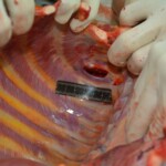 Autopsy of stabbed girl