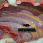 Autopsy of stabbed girl