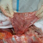 Autopsy of stabbed girl