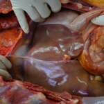 Autopsy of stabbed girl