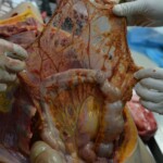 Autopsy of stabbed girl