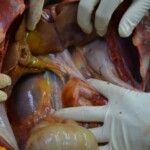 Autopsy of stabbed girl