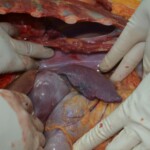 Autopsy of stabbed girl